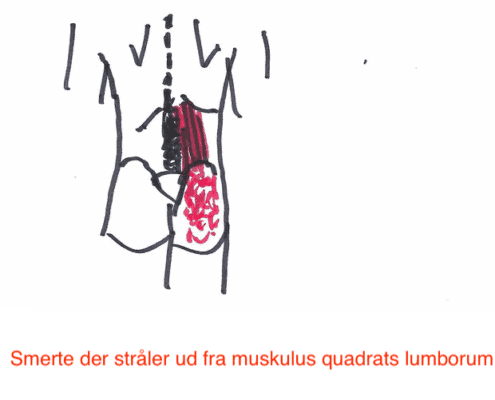 Smerter i ryggen og maven! Sundhedstips fra Klinik Gahlenbeck, Lægeklinik for osteopati og Akupunktur i Kolding.