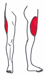 Meralgia ParästheticaKlinik for Osteopati og Akupunktur i Kolding