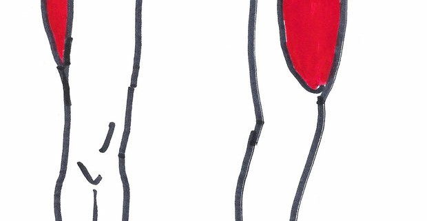 Meralgia ParästheticaKlinik for Osteopati og Akupunktur i Kolding