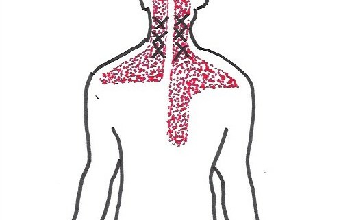 Sundhedstips fra Klinik Gahlenbeck, Lægeklinik for osteopati og Akupunktur i Kolding. Nakken er årsag til mange smerter og ubehag!