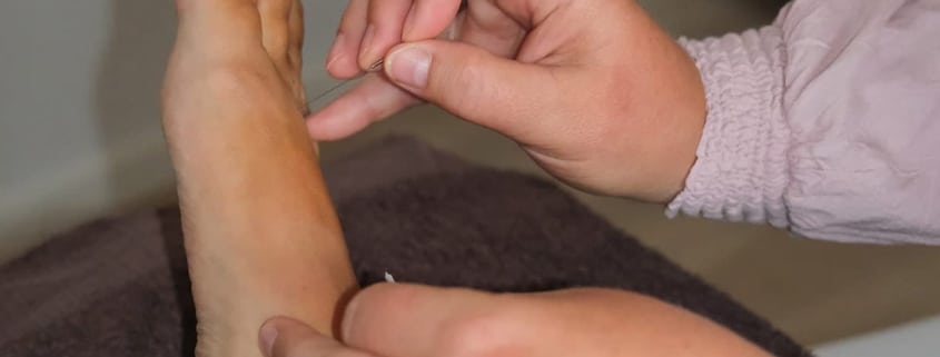 Akupunktur: det bedste valg mod afhængighed, angst og smerter! En alternativ til opioider og vanedannende medicin. Sundhedstips fra Klinik Gahlenbeck, Lægeklinik for osteopati og Akupunktur i Kolding.