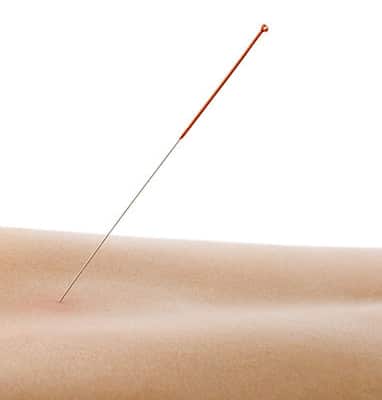  15 spændende spørgsmål om akupunktur Information fra Klinik Gahlenbeck, Lægeklinik for osteopati og Akupunktur i Kolding.