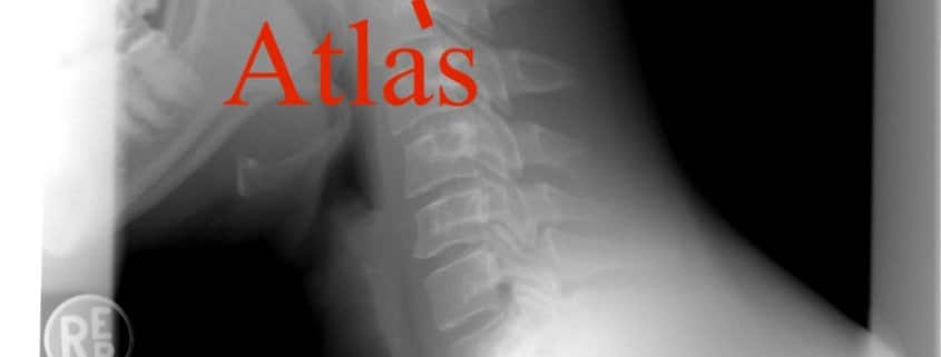 Atlas terapi efter Arlen, hvad er det? Hvor kan det hjælpe? Sundhedstips fra Klinik Gahlenbeck, Lægeklinik for osteopati og Akupunktur i Kolding.