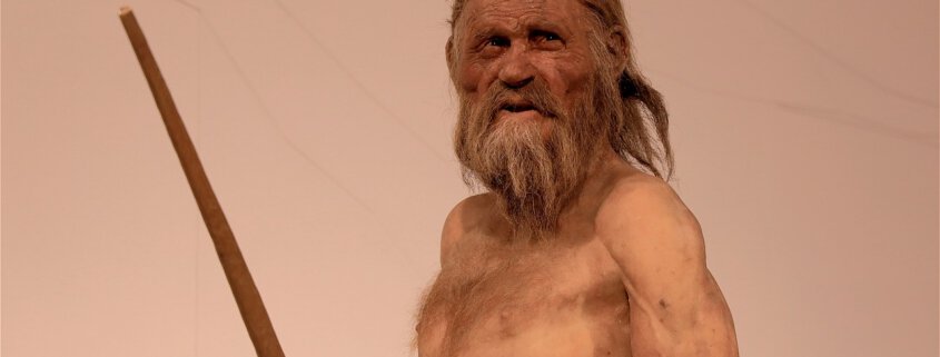 Den ældste kendte "akupunkturpatient" er Ötzi. Sundhedstips fra Klinik Gahlenbeck, Lægeklinik for osteopati og Akupunktur i Kolding.