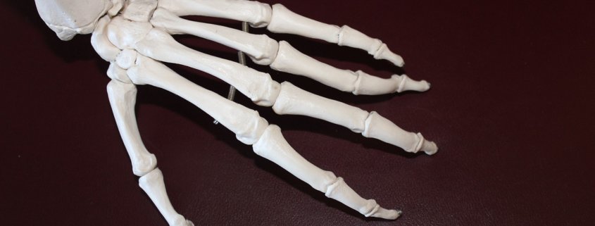skeleton 778069 1280