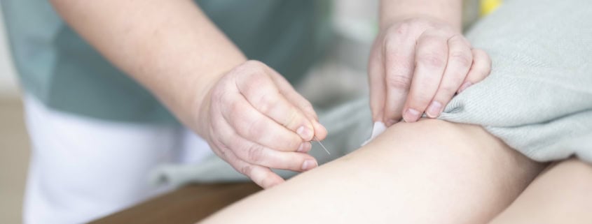 lindring med akupunktur