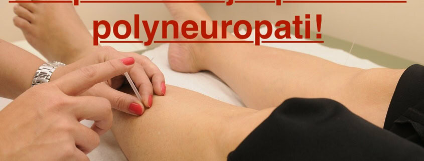 Akupunktur kan hjælper mod polyneropayti! Klinik Gahlenbeck i Kolding