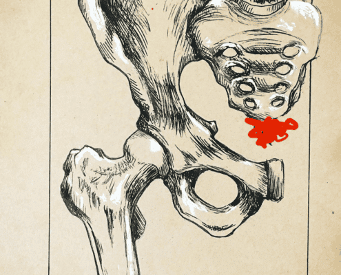Coccyx syndrom Klinik for Osteopati og Akupunktur i Kolding