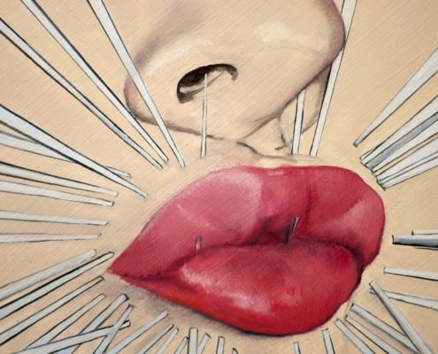Facelift akupunktur Klinik Gahlenbeck