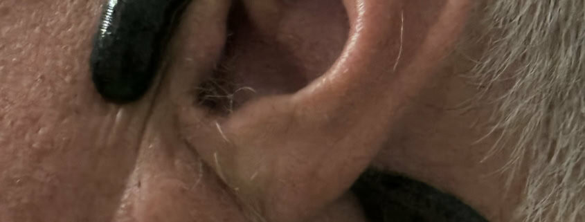Igler mod tinnitus