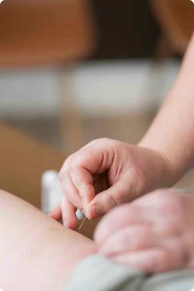 Patient får akupunktur i låret i Kolding
